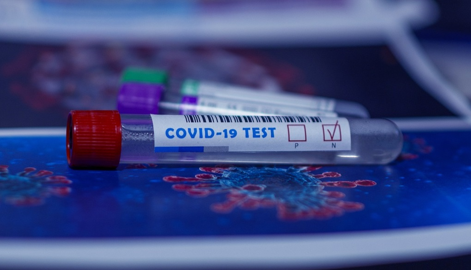 FOTO: Covid tests