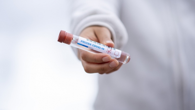 FOTO: Covid tests