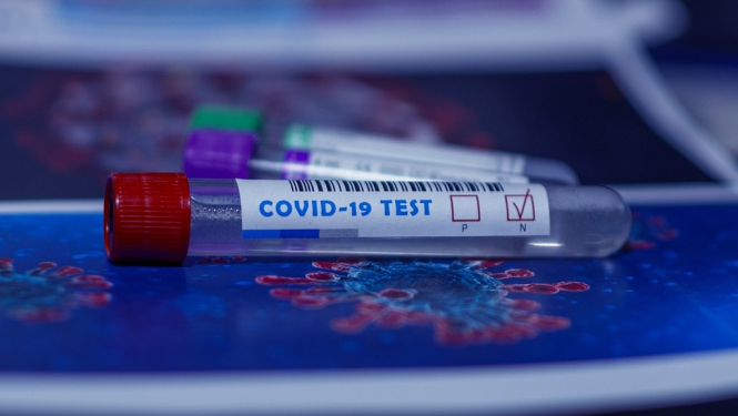 FOTO: Covid tests