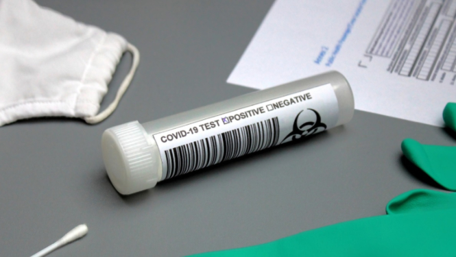 FOTO: Covid-19 tests