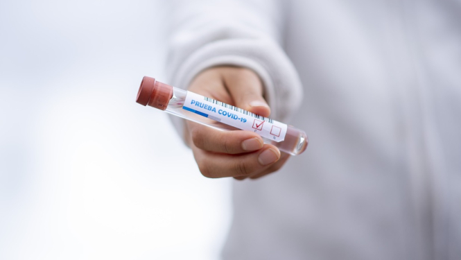 FOTO: Covid tests