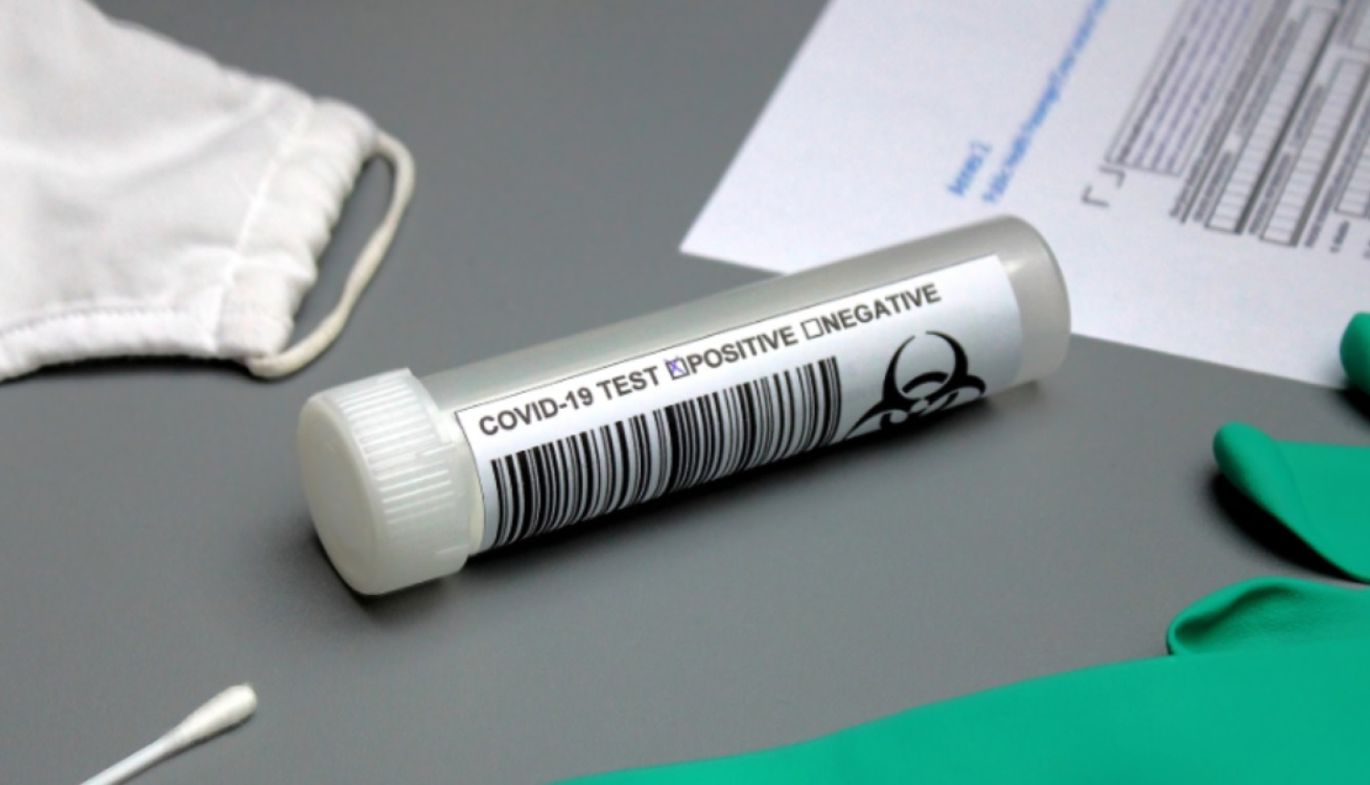 FOTO: Covid-19 tests